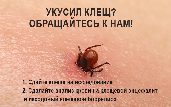 ЧТО ДЕЛАТЬ, ЕСЛИ УКУСИЛ КЛЕЩ?